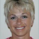 Facelift Before and After Pictures Indianapolis, IN