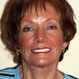 Facelift Before and After Pictures Indianapolis, IN
