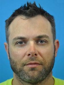 Hair Transplant Before and After Pictures Indianapolis, IN