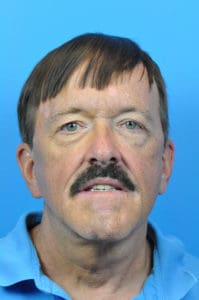 Facelift Before and After Pictures Indianapolis, IN