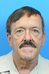 Facelift Before and After Pictures Indianapolis, IN