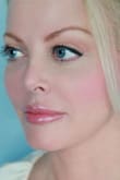 Mini Face Lift Before and After Pictures Indianapolis, IN