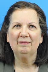Facelift Before and After Pictures Indianapolis, IN
