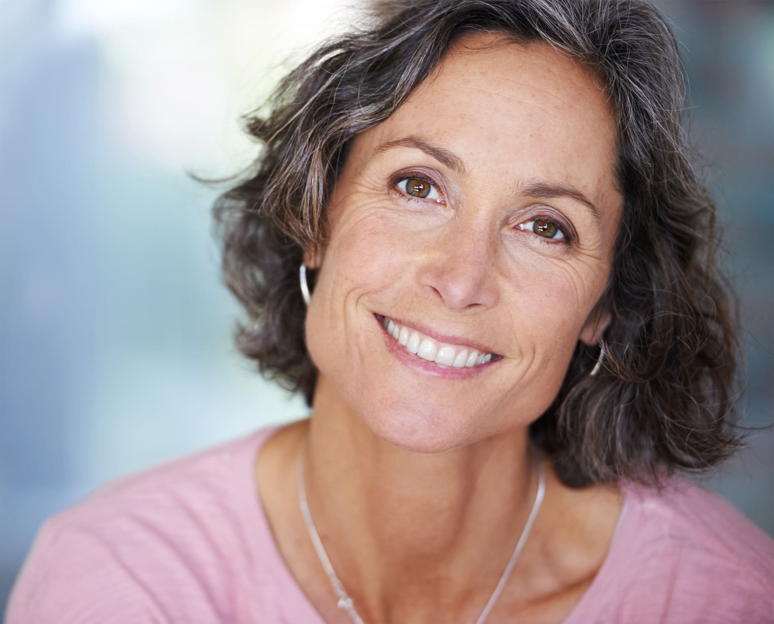 She always shines with elegant beauty Cheek Augmentation in Indianapolis, Indiana