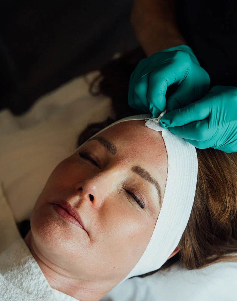 Close up of a person receiving a facial treatment. They are lying down with their eyes closed, and a white strip is across their forehead. A person wearing teal gloves is carefully working on the clients forehead. - Chemical Peels in Carmel, IN
