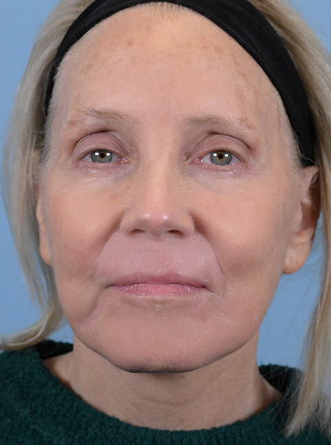 fl6