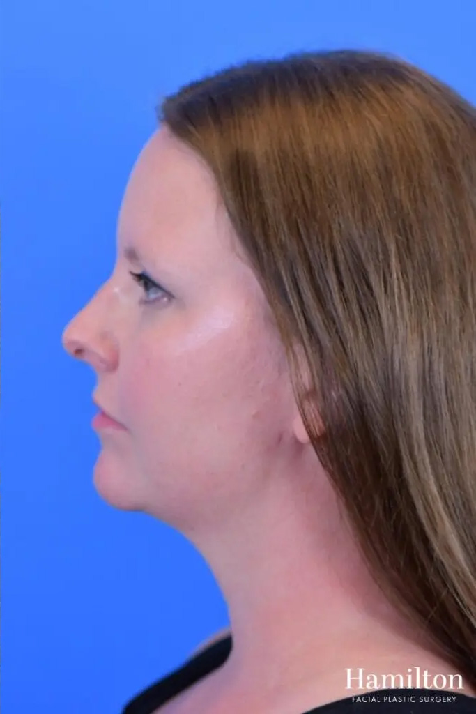 ft6