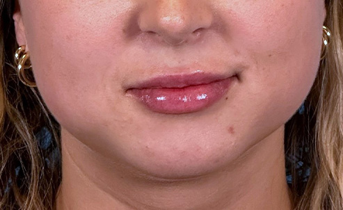 lip2