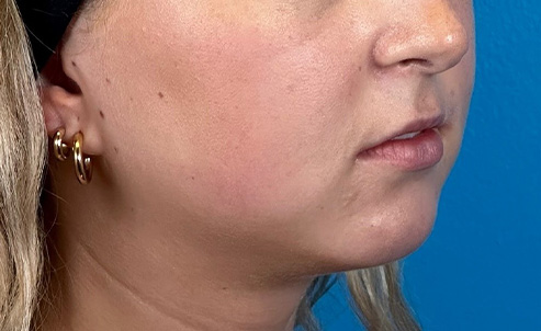 lip3
