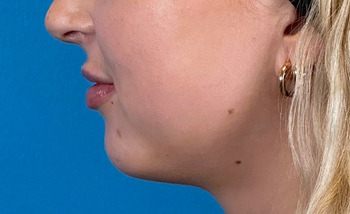 lip6