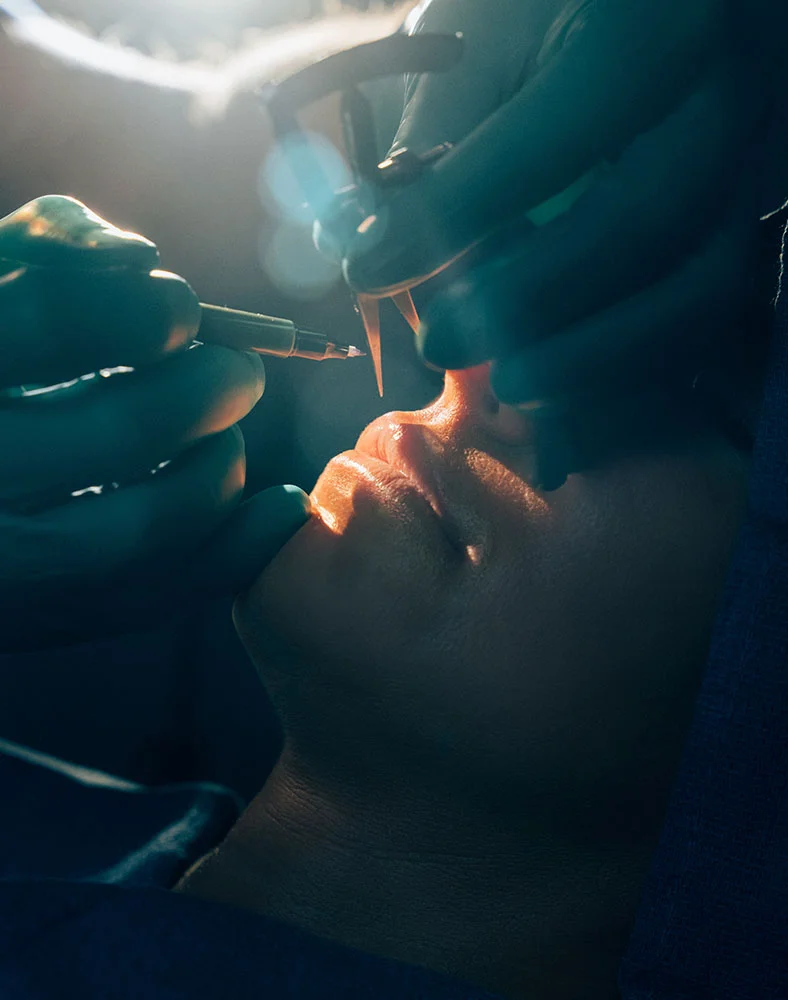 Close-up of a rhinoplasty procedure in progress. A patient lies on their back with the surgeon’s teal-gloved hands holding a thin surgical instrument near the nose and mouth area. Bright surgical lighting highlights the operation site, while the surrounding environment is dimly lit, consistent with a clinical operating room. - Lip Lift in Carmel, IN