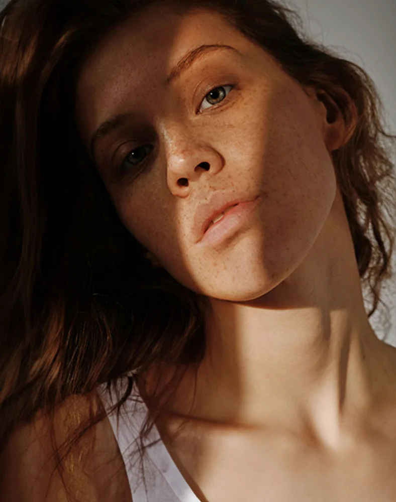 Close-up of a young woman with long, dark brown hair and light-medium skin, featuring visible freckles. She wears a white tank top and looks slightly downward to the left. Natural sunlight casts soft shadows across her face, highlighting her features and skin texture. - Microdermabrasion in Carmel, IN