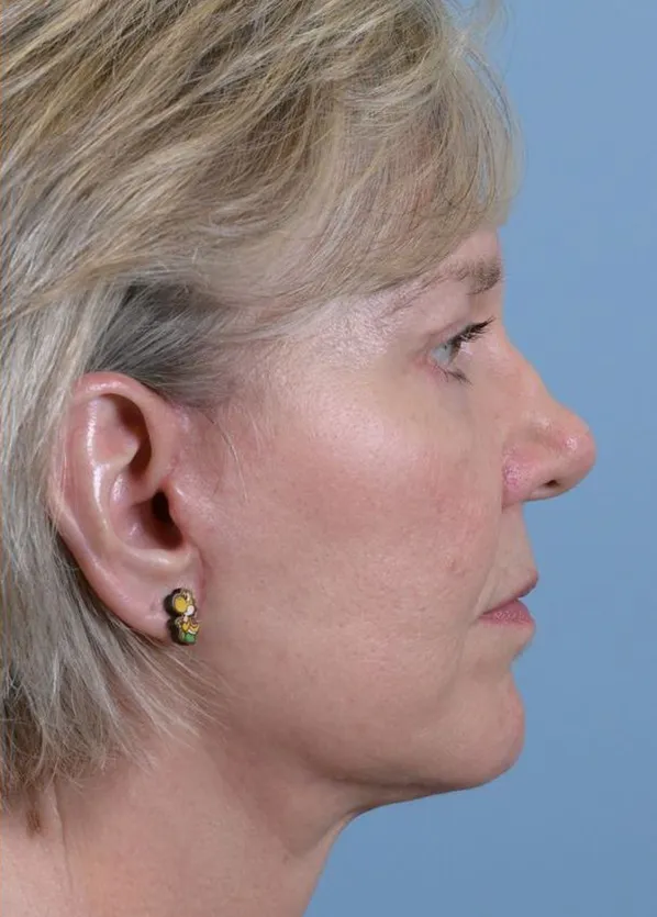 Comprehensive Facial Rejuvenation_p02-06